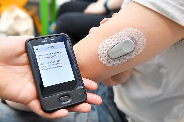 Exploring Needleless Glucose Monitoring: Technology and Benefits