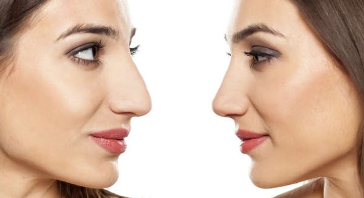La guía completa para el cambio de imagen nasal: redefina su apariencia con confianza